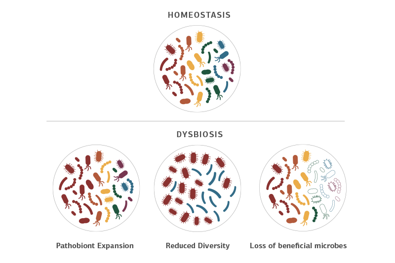 Image showing Homeostatis in the gut bacteria versus Dybiosis.